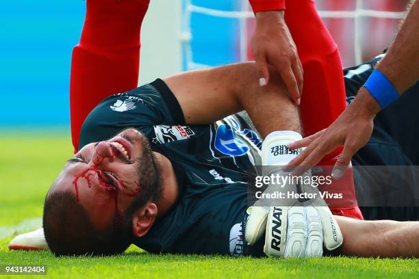 Lucero Alvarez goalkeeper of Lobos BUAP lies on the grass with a bleeding injury after being hit to the face during the 14th round match between Cruz...