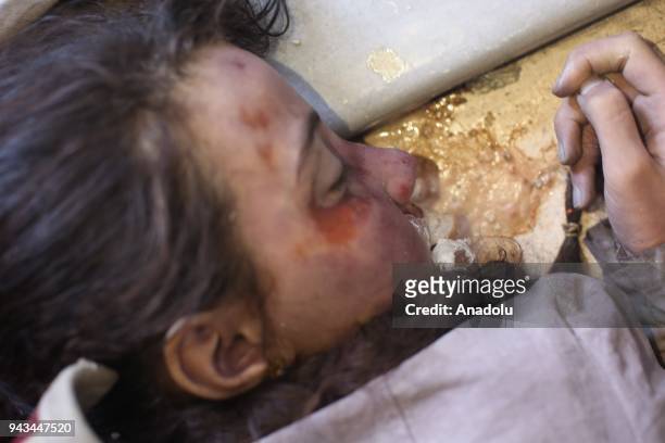 Dead body of a Syrian kid is seen after Assad regime forces allegedly conducted poisonous gas attack to Douma town of Eastern Ghouta in Damascus,...