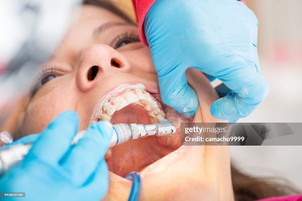 Dental Pumice Cleaning Procedure Close-up