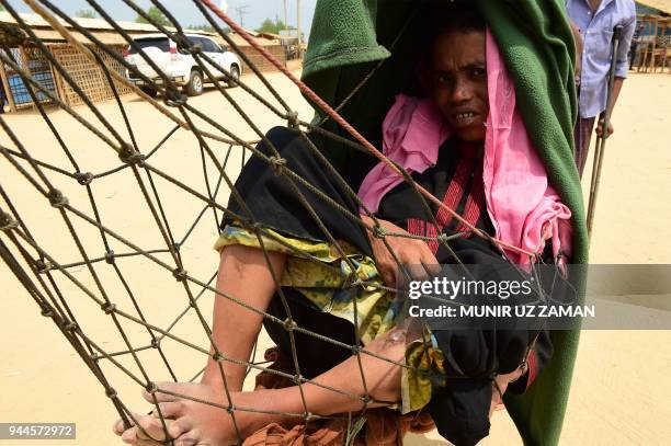 An injured Rohingya woman arrives to attend a meeting with Myanmar Social Welfare Minister Win Myat Aye during his visit to the Kutupalong refugee...