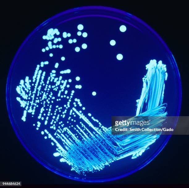 Legionella colonies illuminated using ultraviolet light, cultured on an agar plate, 2005. Image courtesy Centers for Disease Control .