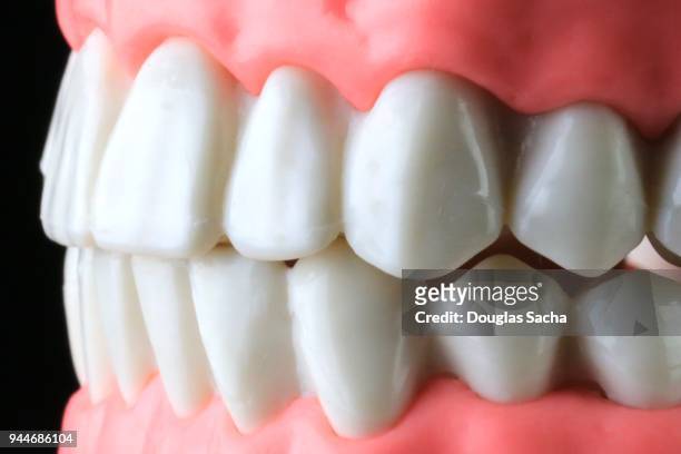 full frame of human teeth - dental explorer stockfoto's en -beelden