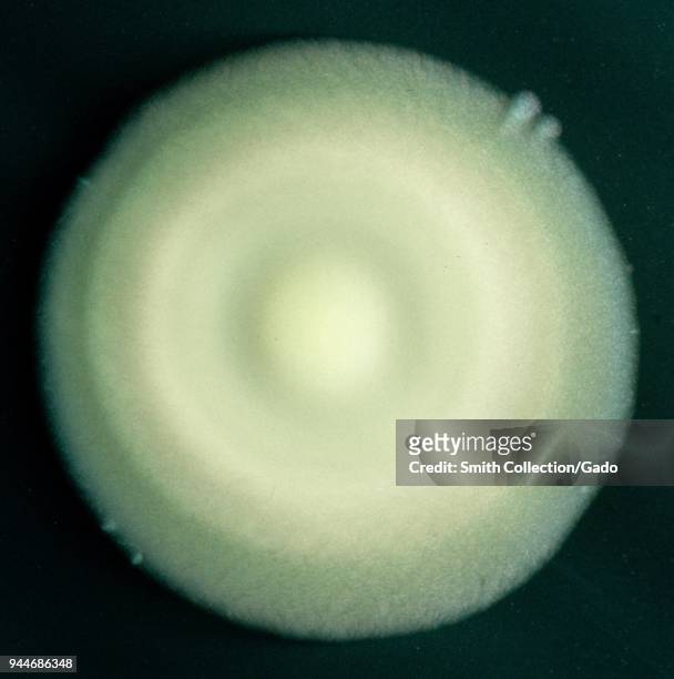 Enlarged view of a single Legionella colony cultured on an agar plate, 2005. Image courtesy Centers for Disease Control .