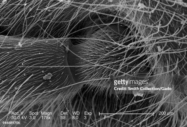 Western honeybee's ball and socket joint at the base of the sensory antenna, revealed in the 178x magnified scanning electron microscopic image,...