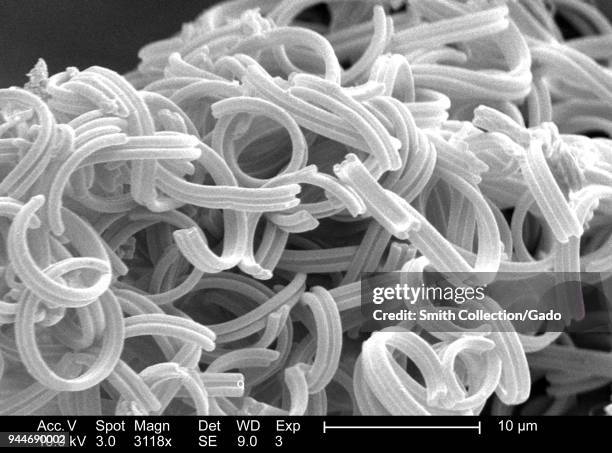Sem Insect Insect Sem Photos and Premium High Res Pictures - Getty Images