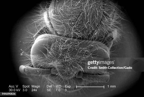 Western honeybee's head and thorax depicted in the 24x magnified scanning electron microscopic image, 2005. Image courtesy Centers for Disease...