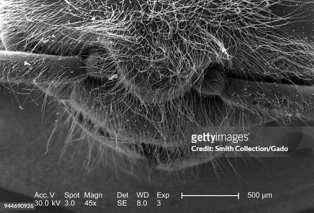 Western honeybee's head and thorax depicted in the 45x magnified scanning electron microscopic image, 2005. Image courtesy Centers for Disease...