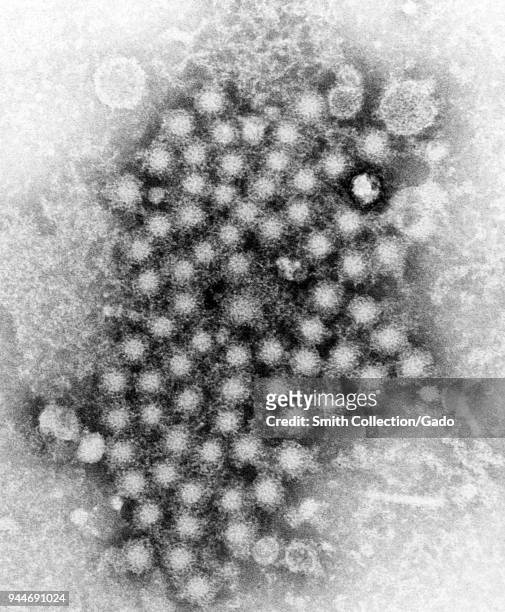 Hepatitis virions of an unknown strain of the organism revealed in the transmission electron microscopic image, 1962. Image courtesy Centers for...