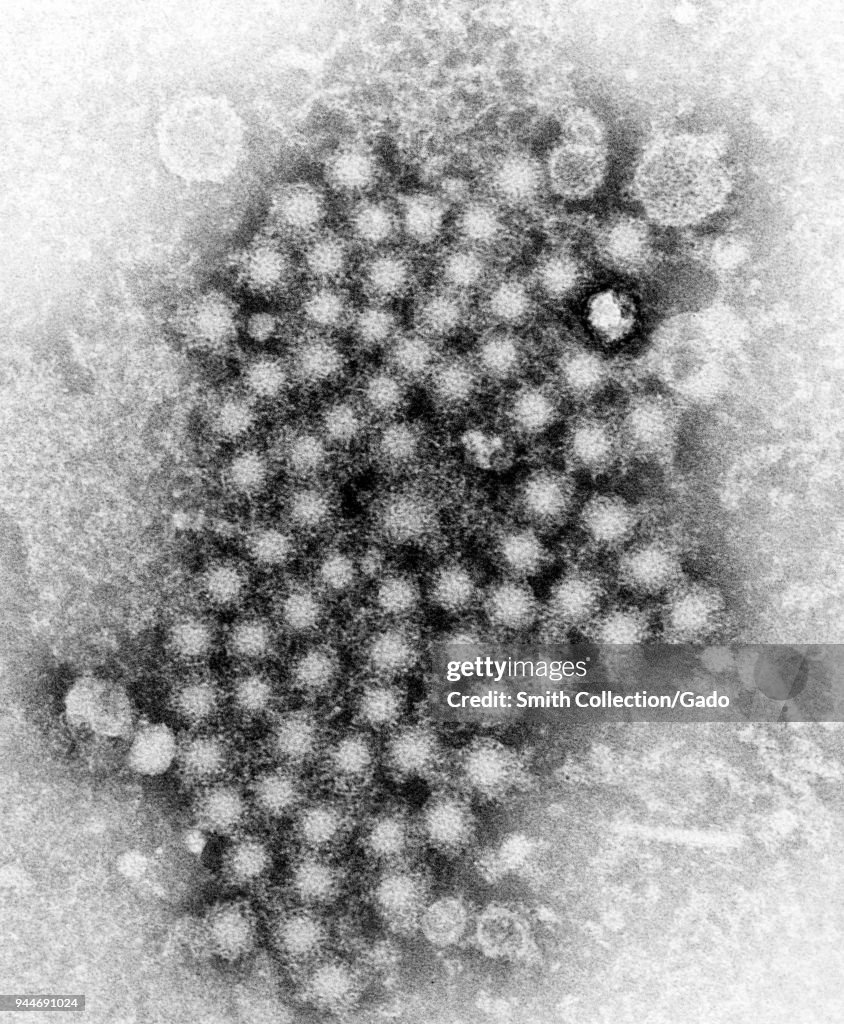 Hepatitis Virions