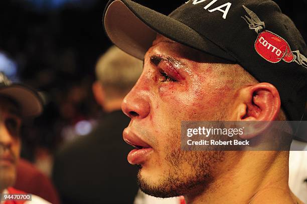 Welterweight Title: Closeup of Miguel Cotto after losing fight to Manny Pacquiao at MGM Grand Garden Arena. Las Vegas, NV CREDIT: Robert Beck