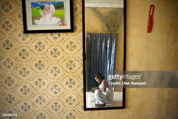 Indonesian man Dede Koswara sitting in his home village on December 16, 2009 in Bandung, Java, Indonesia. Due to a rare genetic problem with Dede�s...
