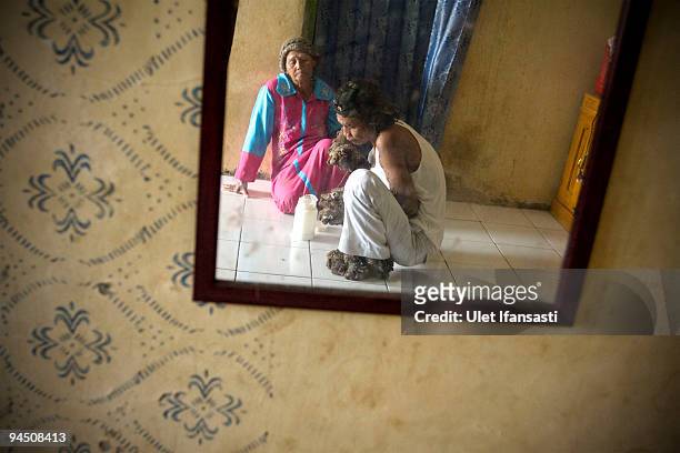 Indonesian man Dede Koswara treat illness with his mother named Engkar in his home village on December 16, 2009 in Bandung, Java, Indonesia. Due to a...