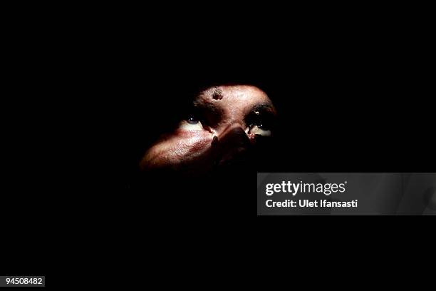 Indonesian man Dede Koswara with is seen in his home village on December 16, 2009 in Bandung, Java, Indonesia. Due to a rare genetic problem with...