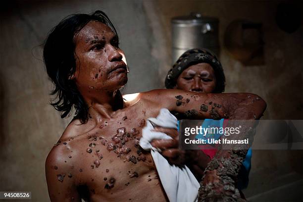 Indonesian man Dede Koswara bath with the way in flush with a damp cloth in his home village on December 16, 2009 in Bandung, Java, Indonesia. Due to...