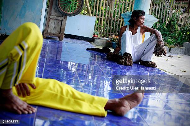 Indonesian man Dede Koswara sitting in front house with his parents in his home village on December 16, 2009 in Bandung, Java, Indonesia. Due to a...