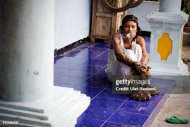 Indonesian man Dede Koswara smoking in his home village on December 16, 2009 in Bandung, Java, Indonesia. Due to a rare genetic problem with Dede�s...