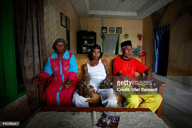 Indonesian man Dede Koswara with his parents is seen in his home village on December 16, 2009 in Bandung, Java, Indonesia. Due to a rare genetic...