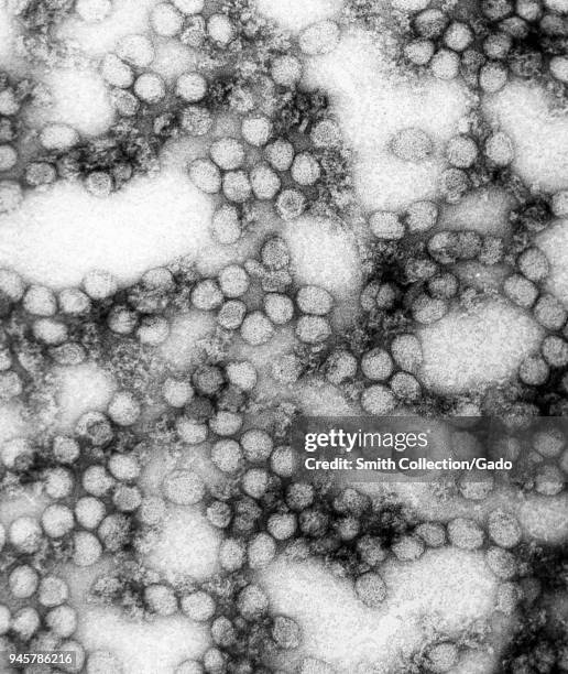 Multiple virions of the yellow fever virus revealed in the highly magnified transmission electron microscopic image, 1980. Image courtesy Centers for...