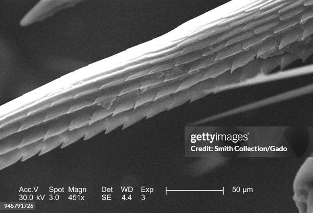 Anatomical morphology in the exoskeletal adnexal barb of an unidentified roach, depicted in the 451x magnified scanning electron microscopic image,...