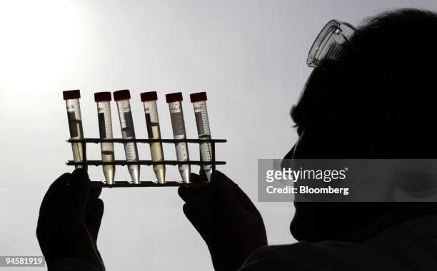 Professor Frank Barry checks some samples at the Regenerative Medicine Institute at University College Galway, Ireland, on March 14, 2007. Big...