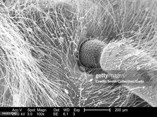 Socket Insect 21 Ball And Socket Joint Stock Photos, High-Res Pictures, and Images ...