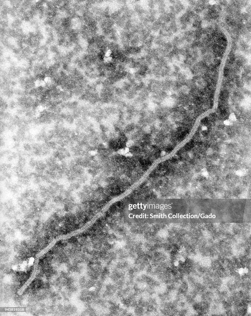 Nipah Virus