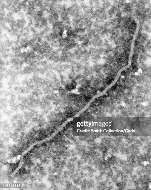 Ultrastructural details of a Nipah virus nucleocapsid, revealed in the 168.000x magnified transmission electron micrographic image, 1999. Image...