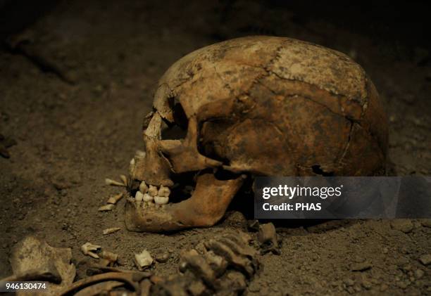 Viking Age. Birka girl. Died at age 6 years. 10th century. Skeleton. Skull. Historical Museum. Stockholm, Sweden.