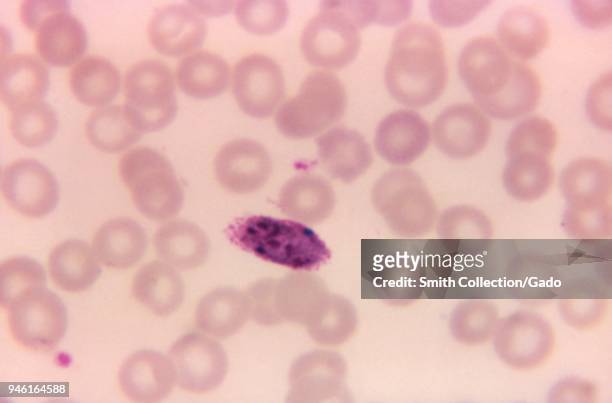 Plasmodium ovale schizont revealed in the photomicrograph film using Giemsa stained method, 1979. Image courtesy Centers for Disease Control / Dr Mae...