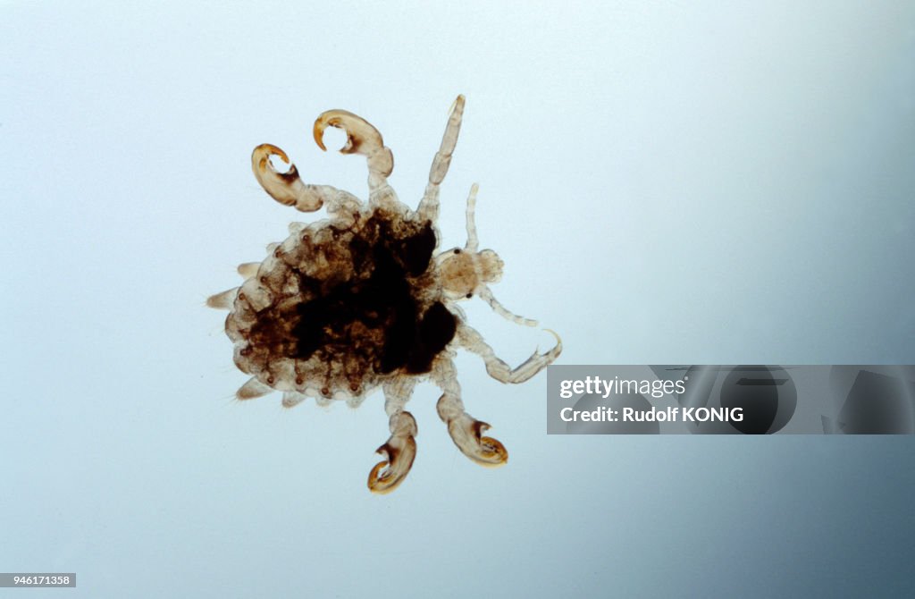 MORPION, Phthirus pubis