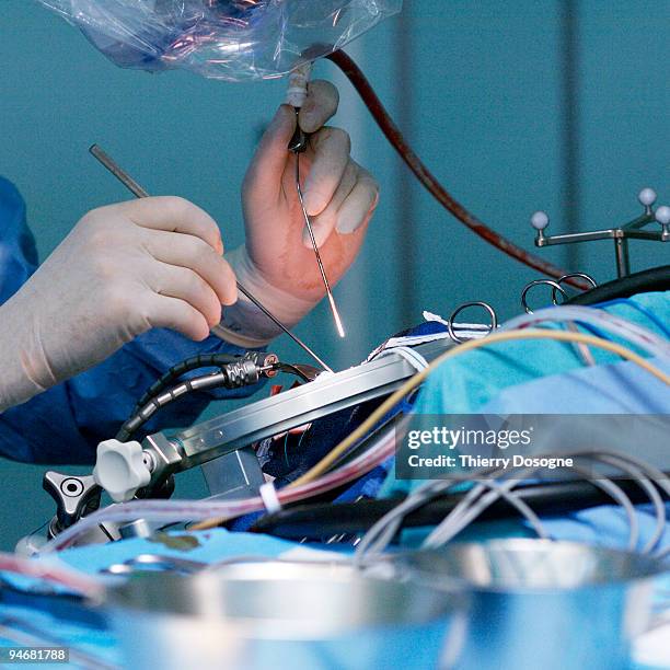 neurosurgery, brain operation - neurosurgery stock-fotos und bilder