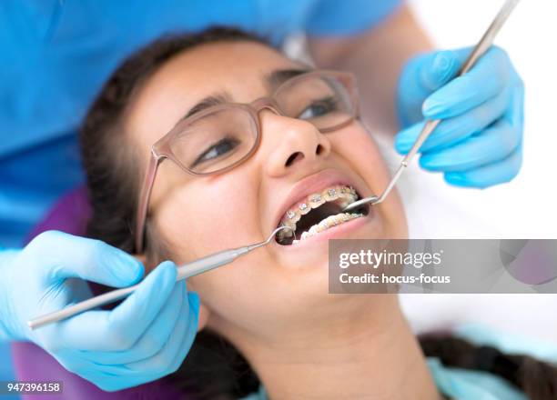 dentista che controlla le parentesi graffe dentali della bambina - dentista bambini foto e immagini stock