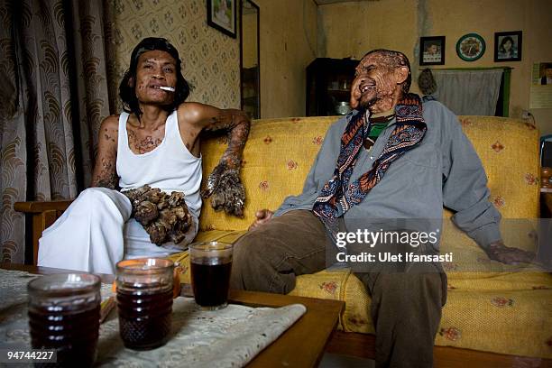 97 fotos e imágenes de Dede Tree Man