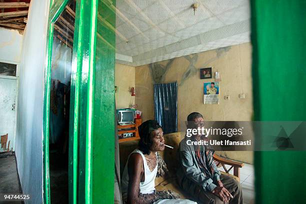 Indonesian man Dede Koswara talks with his friend Sakim in his home village on December 18, 2009 in Bandung, Java, Indonesia. Due to a rare genetic...