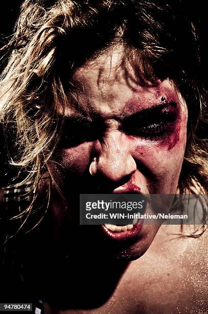 close-up of an injured woman screaming - bruised finger stock-fotos und bilder