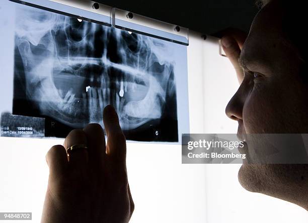 Consultant dental surgeon studies an x-ray of a patient's mouth at a hospital in London, U.K., on Thursday, Nov. 20, 2008. Funding to tackle hospital...