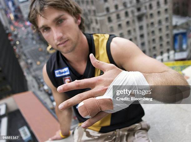 Brett Backwell shows his amputated finger on the balcony of his hotel room in New York on Friday, September 23, 2005. Brett had his finger amputated...