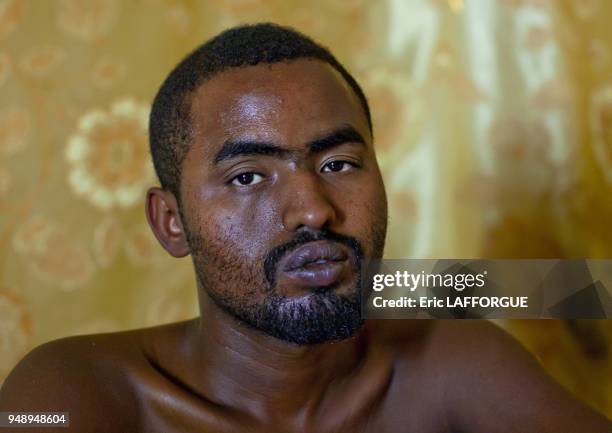 Drug Addict African Man Looking At Camera Portrait In Hargeisa, Somaliland.