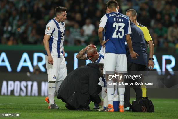 Porto defender Maxi Pereira from Uruguay injured with a broken head during the Sporting CP v FC Porto - Portuguese Cup semi finals 2 leg at Estadio...