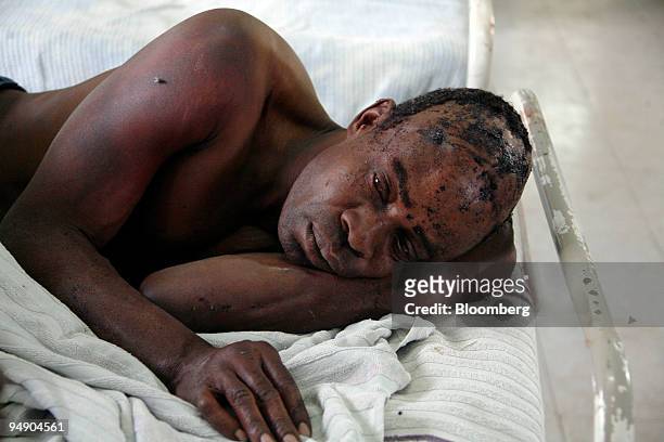 Victim of post-election violence receives treatment in a hospital in Naivasha, 90 km from Nairobi, Kenya, on Monday, Jan. 28, 2008. Kenya's spreading...