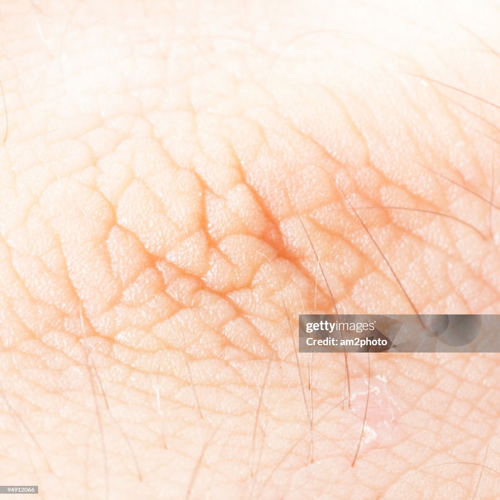 Skin