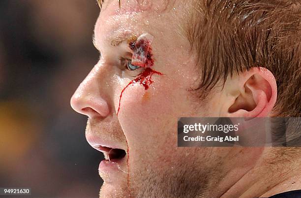 Mike Komisarek of the Toronto Maple Leafs looks on with blood running down his face during a break in game action against the Boston Bruins December...