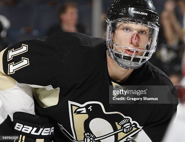 Jordan Staal of the Pittsburgh Penguins looks on after getting hit in the face with a puck against the New Jersey Devils on December 21, 2009 at...