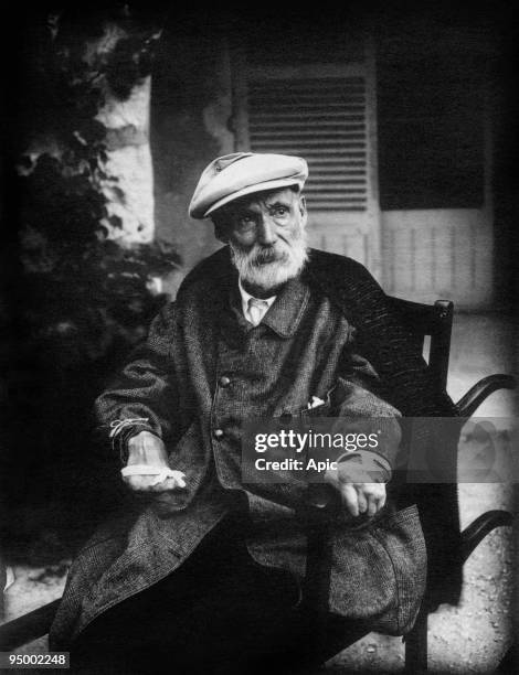 French painter Pierre Auguste Renoir c. 1918 showing his arthritis and the tape he used to strap his brush to his hand