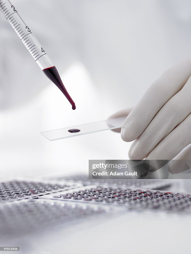 Scientist dropping blood onto microscope slide with pipette