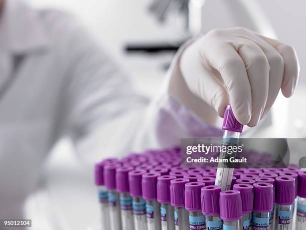 scientist lifting test tube from tray - adam gault stock pictures, royalty-free photos & images