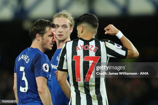 Leighton Baines of Everton suffers a facial injury during the Premier League match between Everton and Newcastle United at Goodison Park on April 23,...