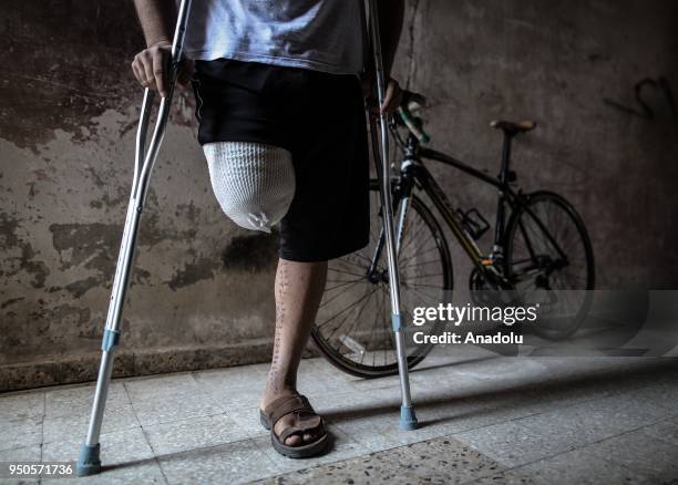 Palestinian cyclist Alaa Al-Daly, who lost his leg by a bullet fired by Israeli soldiers along the Gaza border in a demonstration within "Great March...