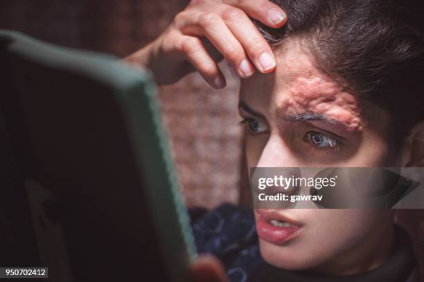 skin inflammation on forehead due to threading. - threading stock pictures, royalty-free photos & images