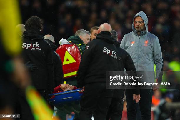 Jurgen Klopp manager / head coach of Liverpool reacts as Alex Oxlade-Chamberlain of Liverpool is taken off on a stretcher during the UEFA Champions...